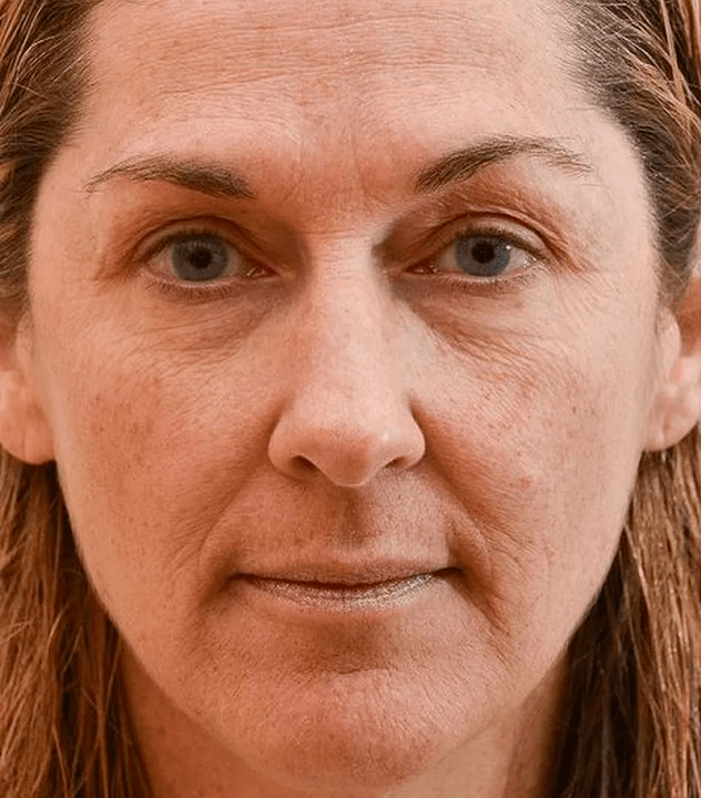 Grapes before the use of the Eudalie Cream