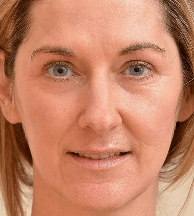 I look younger after the Eudalie cream is applied