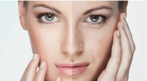 The effective rejuvenation of the face